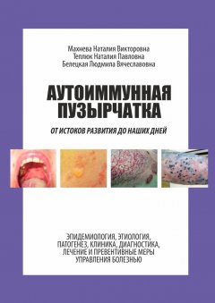 Людмила Белецкая - Аутоиммунная пузырчатка. От истоков развития до наших дней